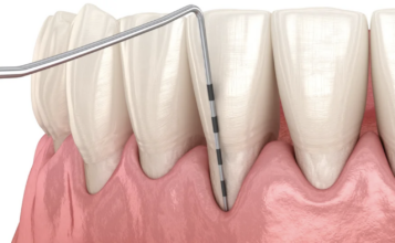 Crown Lengthening and Alveolar Ridge Preservation